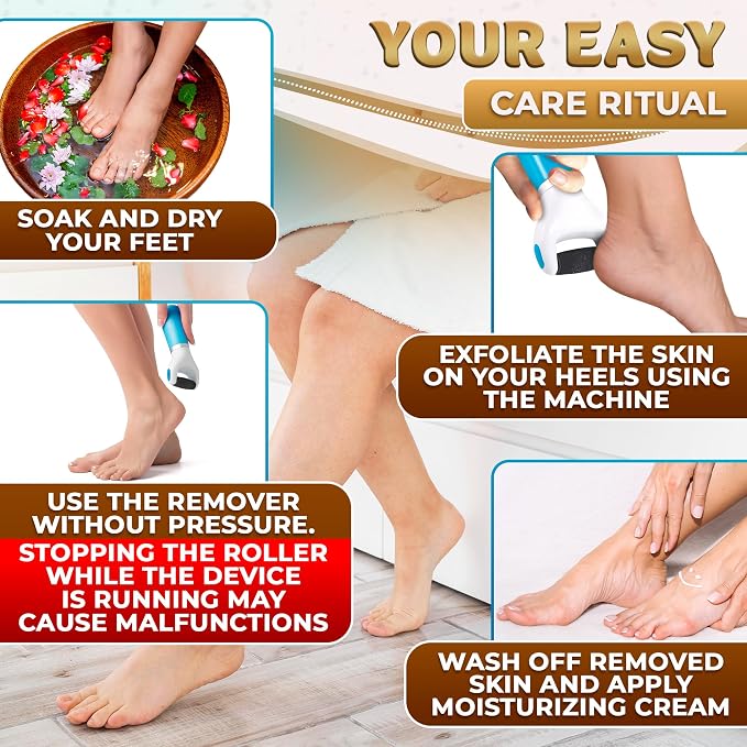 Electric Foot Callus Remover Tool | Batteries Not Included – High-Speed Foot - Image 6