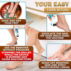 Electric Foot Callus Remover Tool | Batteries Not Included – High-Speed Foot - Image 6