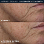 RoC Deep Wrinkle Rich Cream, Fragrance Free, Daily Anti-Aging Firming Cream - Image 5