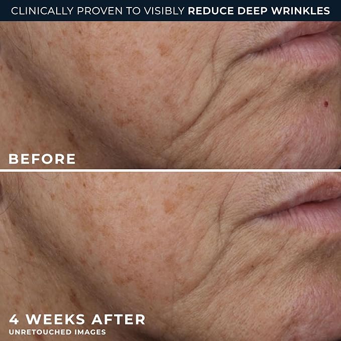RoC Deep Wrinkle Rich Cream, Fragrance Free, Daily Anti-Aging Firming Cream - Image 5