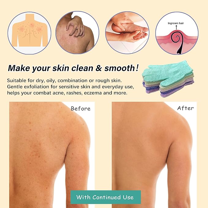 MIG4U Shower Exfoliating Scrub Gloves, Bathing Gloves Body Wash Dead Skin - Image 3