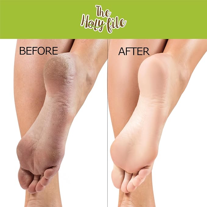 Holy Coarse Foot File, Callus Remover, Double Sided, Wet or Dry - Image 4
