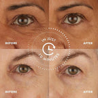 Skyn ICELAND Hydro Cool Firming Under Eye Patches, Instant Cooling - Image 3