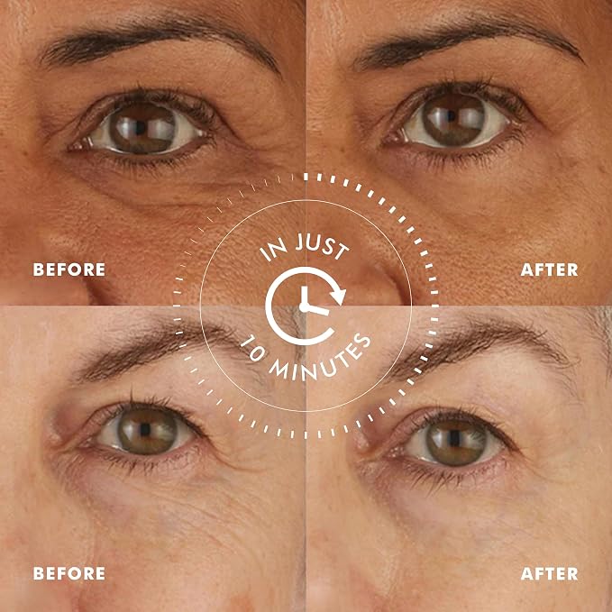Skyn ICELAND Hydro Cool Firming Under Eye Patches, Instant Cooling - Image 3