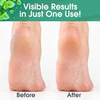 DeEnti Callus Maintenance Pack, Bundle Includes Mint Scented Callus Remover - Image 3