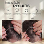 Fiora Naturals Scalp Massager Shampoo Brush - Image 2