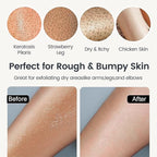 Yiclick Heavy Exfoliating Gloves 4Pcs, Exfoliating Mitts, Body Scrubber - Image 5