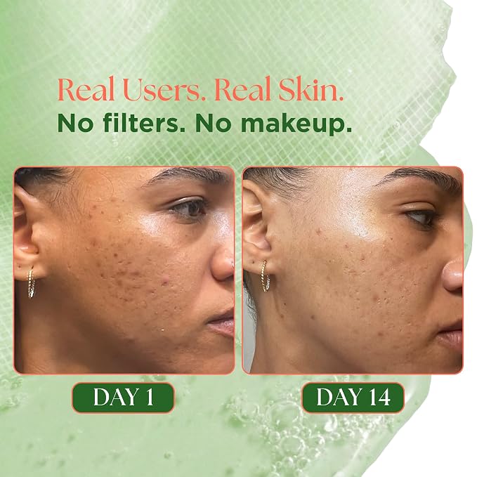 Matcha Toner Pads with Rose PDRN, Peptides & Hyaluronic Acid | Korean Facial - Image 4