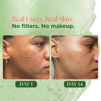 Matcha Toner Pads with Rose PDRN, Peptides & Hyaluronic Acid | Korean Facial - Image 4