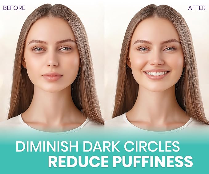 Stylia Under Eye Patches for Puffy Eyes and Dark Circles - Image 5