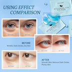 PEAUAMIE Under Eye Patchs Hyaluronic Acid Eye Mask - Image 4