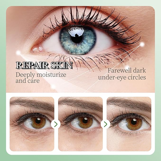 Aloe Vera Under Eye Masks, Eye Bags, Puffy Eyes and Dark Circles Treatments - Image 4