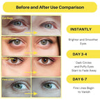 Collagen Under Eye Patches - Image 2