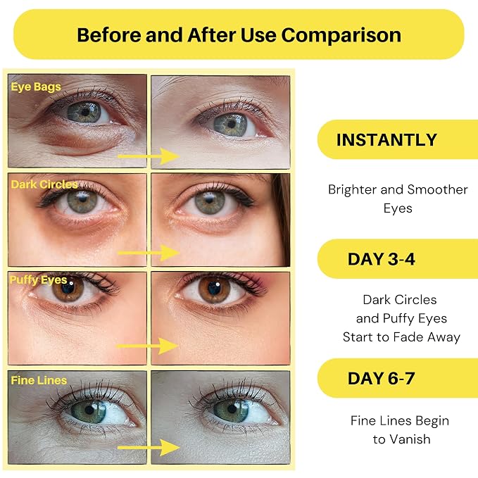 Collagen Under Eye Patches - Image 2