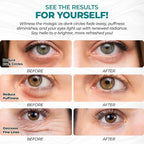 Eye Patches for Reducing Puffy Eyes and Dark Circles, Wrinkles | Eye mask - Image 5
