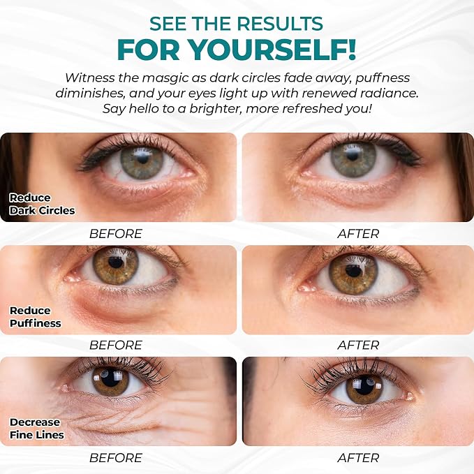 Eye Patches for Reducing Puffy Eyes and Dark Circles, Wrinkles | Eye mask - Image 5