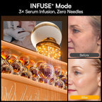 INIA SPHERA Upgraded 8-in-1 Microcurrent Facial Device - Image 7