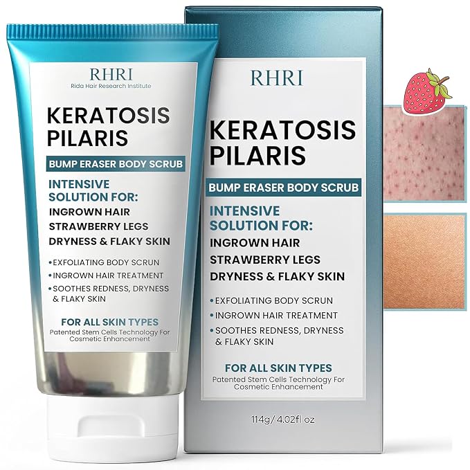 KP Bump Eraser Body Scrub with 10% AHA | Keratosis Pilaris Treatment | Bump by RidaHairResearchInstitute