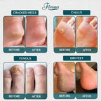 Fivona Tea Tree Foot Soak Blend 14.1 oz - Image 7