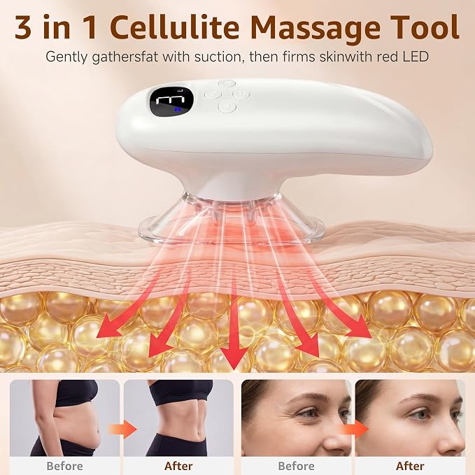 Body Smart Scraping, 3 in 1 Body Sculpting Machine, Cellulite Removal Machine - Image 3