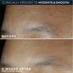 RoC Retinol Correxion Max Hydration Anti-Aging Daily Face Moisturizer - Image 5