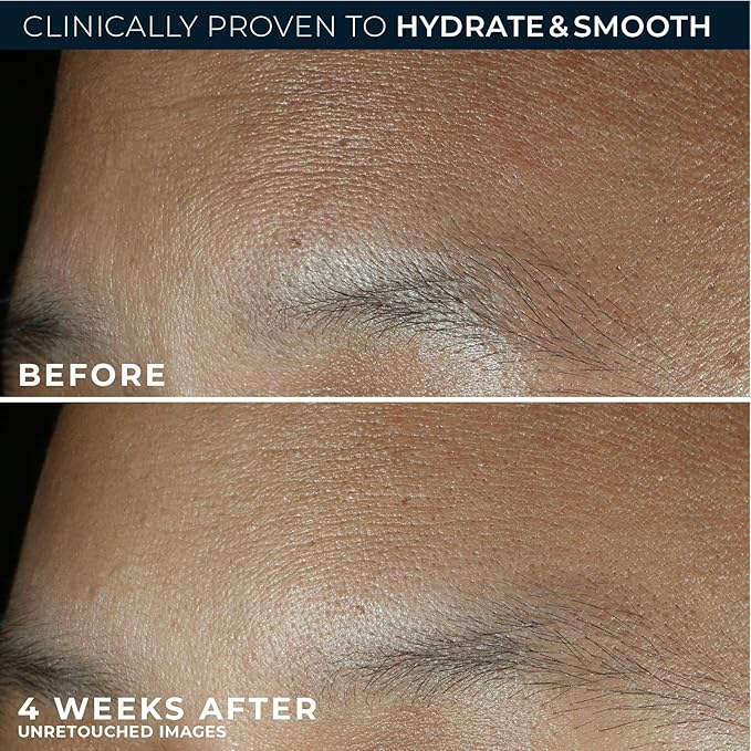 RoC Retinol Correxion Max Hydration Anti-Aging Daily Face Moisturizer - Image 5