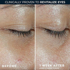 RoC Multi Correxion Revive + Glow Eye Balm - Image 4