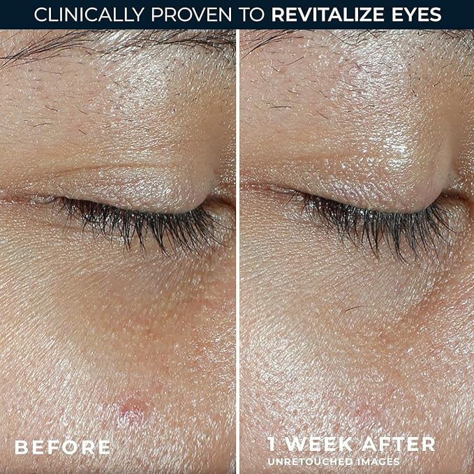 RoC Multi Correxion Revive + Glow Eye Balm - Image 4