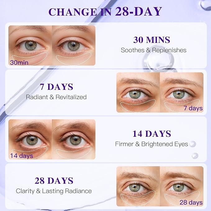 Grape Seed Collagen Under Eye Patches, Eye Mask - Image 6