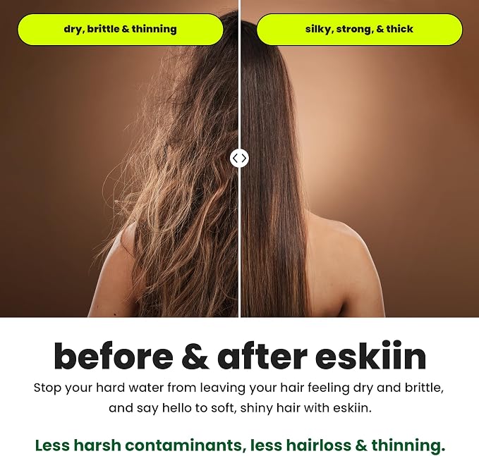 Eskiin Shower Head Water Filter Replacement - Image 3