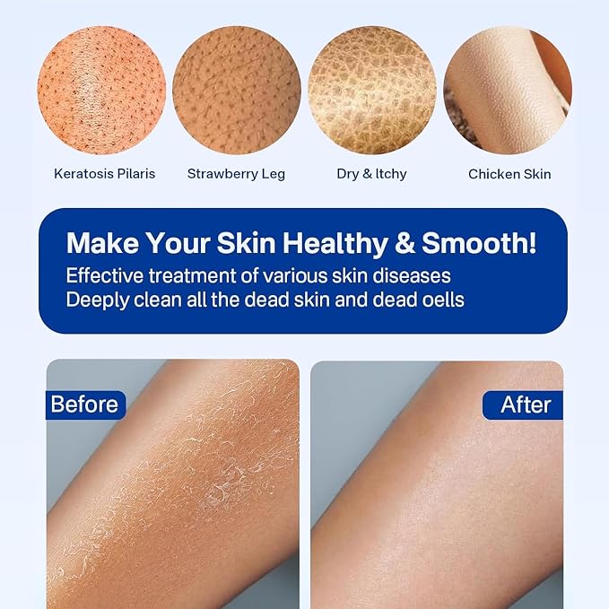 Yiclick Heavy Exfoliating Gloves, Exfoliating Body Scrubber - Image 5