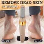 Foot Callus Remover Electric – Callus Grinder - Image 6