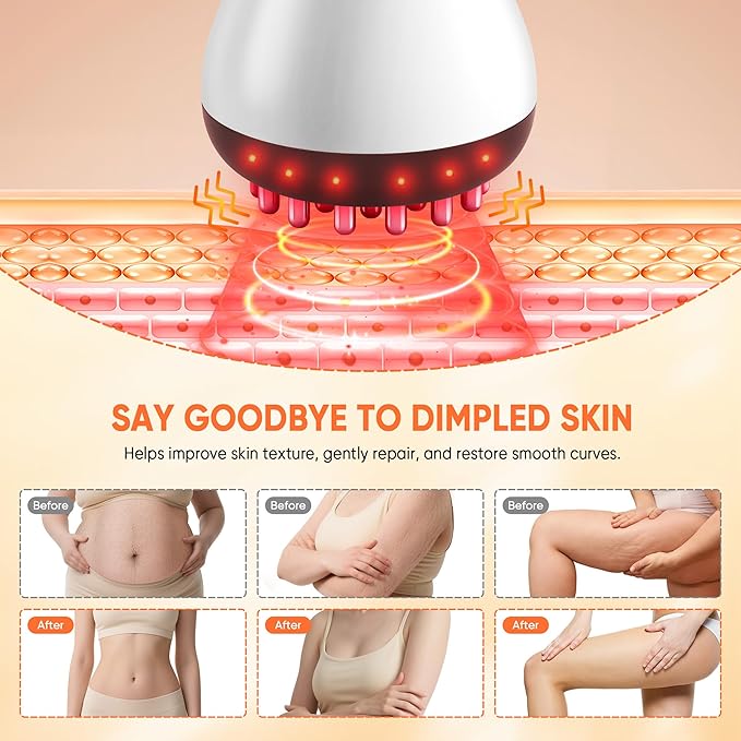 Rechargeable Lymphatic Drainage Massager & Cellulite Massage Tool - Image 5