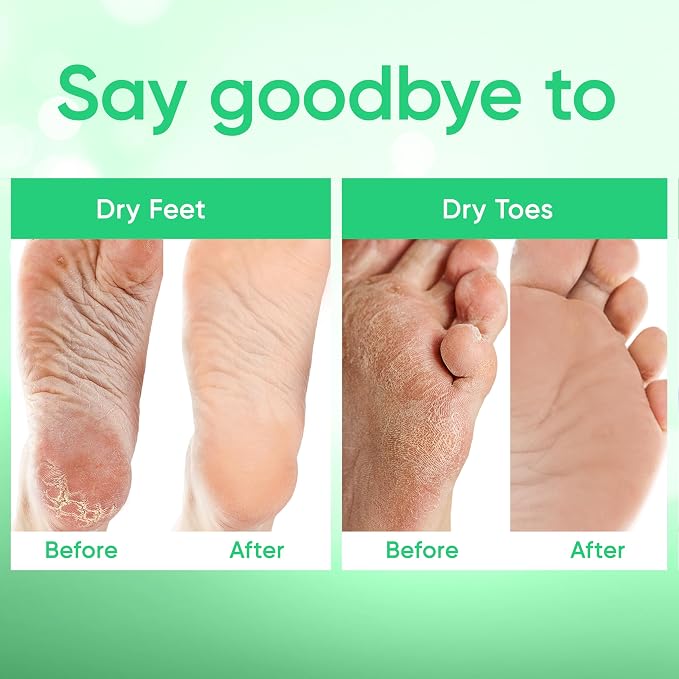 Foot Peel Mask - Foot Mask for Baby Soft Skin - Remove Dead Skin, Cracked Feet - Image 5