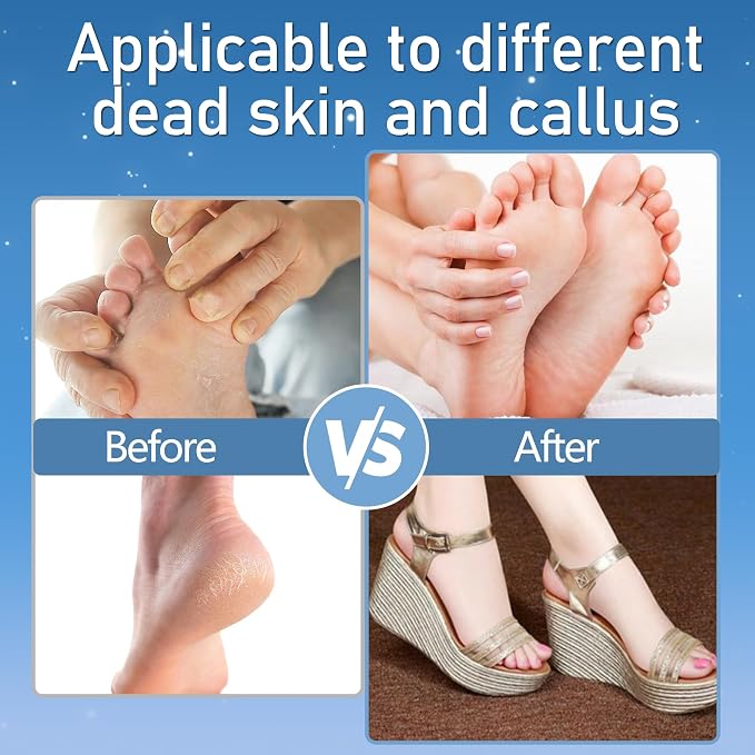 Callus Remover for Feet, Electric Foot Callus Remover Waterproof - Image 7