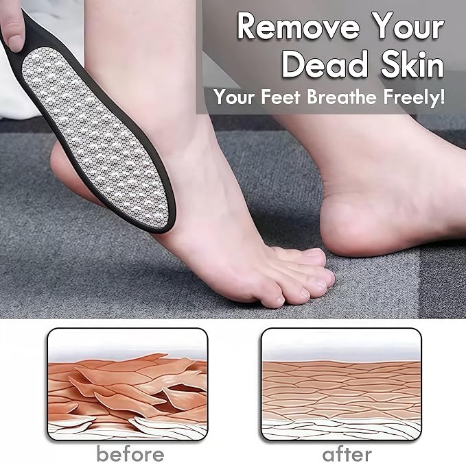 3 in 1 Large Size Durable Foot File Callus Remover - Image 4