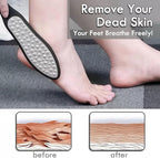3 in 1 Large Size Durable Foot File Callus Remover - Image 4