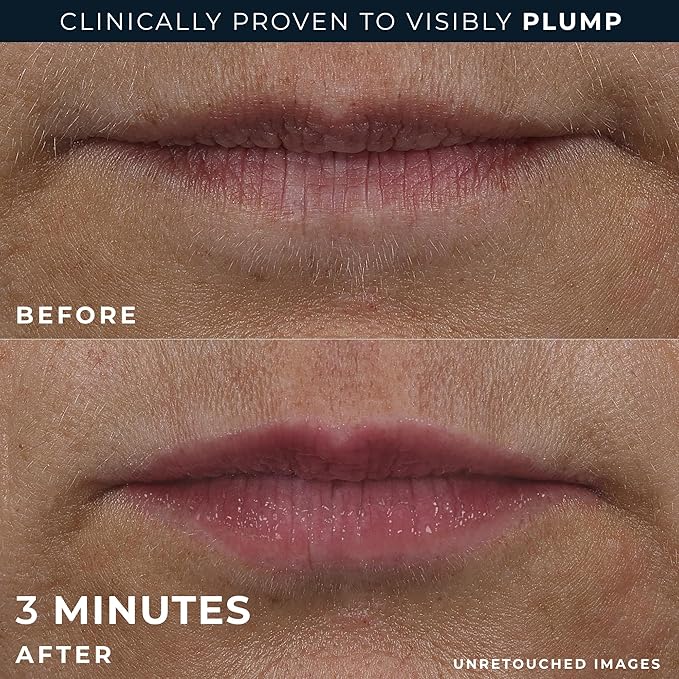 RoC Derm Correxion Lip Volumizer - Image 5