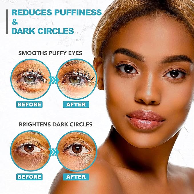 Under Eye Patches For Puffy Eyes And Dark Circles - Image 6