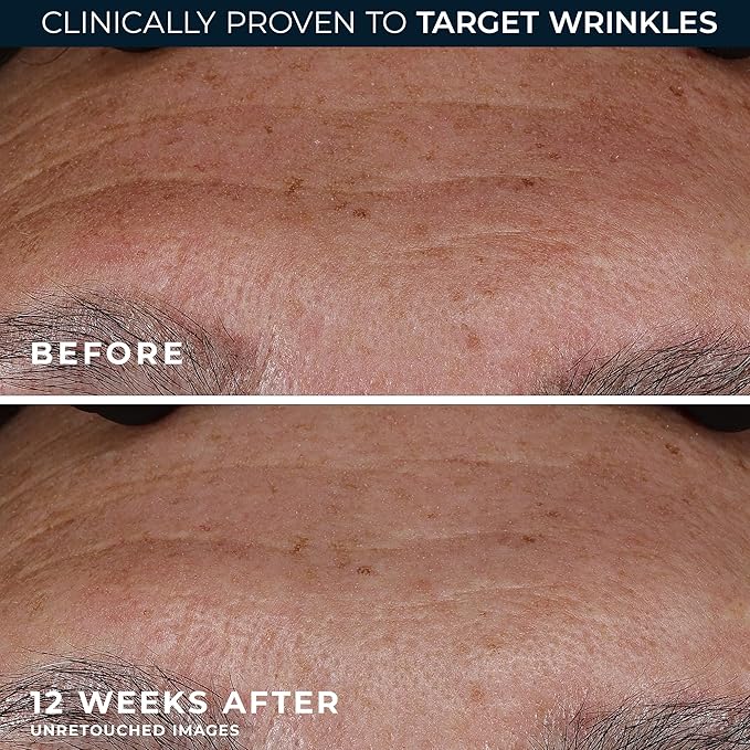 RoC Retinol Correxion Deep Wrinkle Retinol Face Serum - Image 5