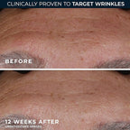 RoC Retinol Correxion Deep Wrinkle Retinol Face Serum - Image 5