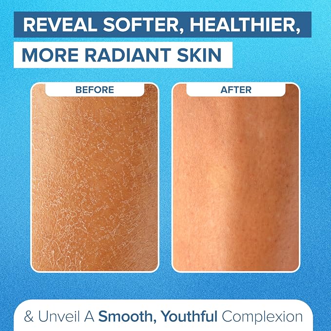 DEEP Exfoliation Body Exfoliating Glove - Image 5