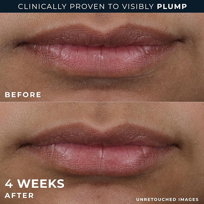 RoC Derm Correxion Lip Volumizer - Image 6