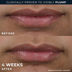 RoC Derm Correxion Lip Volumizer - Image 6