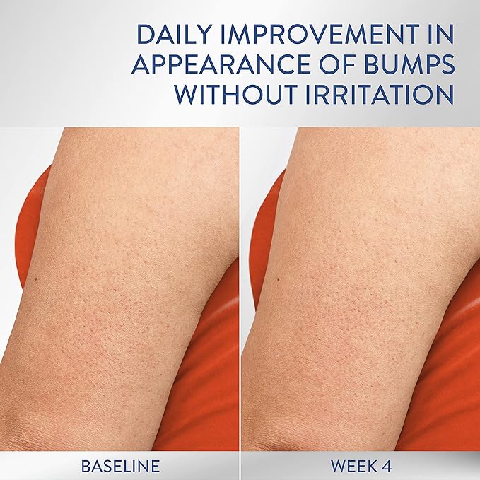 Cetaphil Daily Smoothing Moisturizer - Image 5