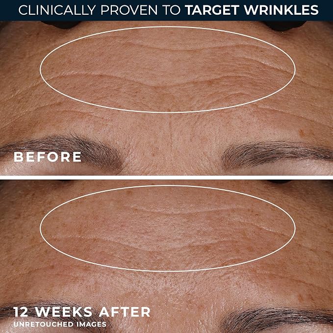 RoC Retinol Correxion Night Cream - Image 5