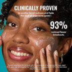 Good Molecules 10% Azelaic Acid Treatment - Image 5